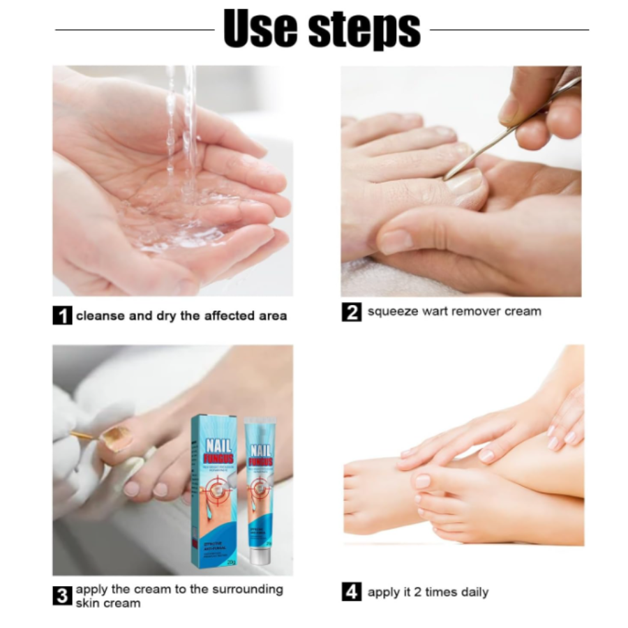 Crema de Uñas Tratamiento para Hongos