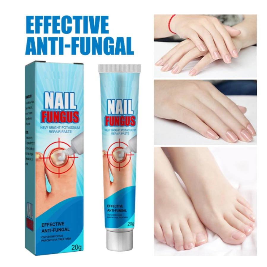 Crema de Uñas Tratamiento para Hongos