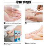 Crema de Uñas Tratamiento para Hongos