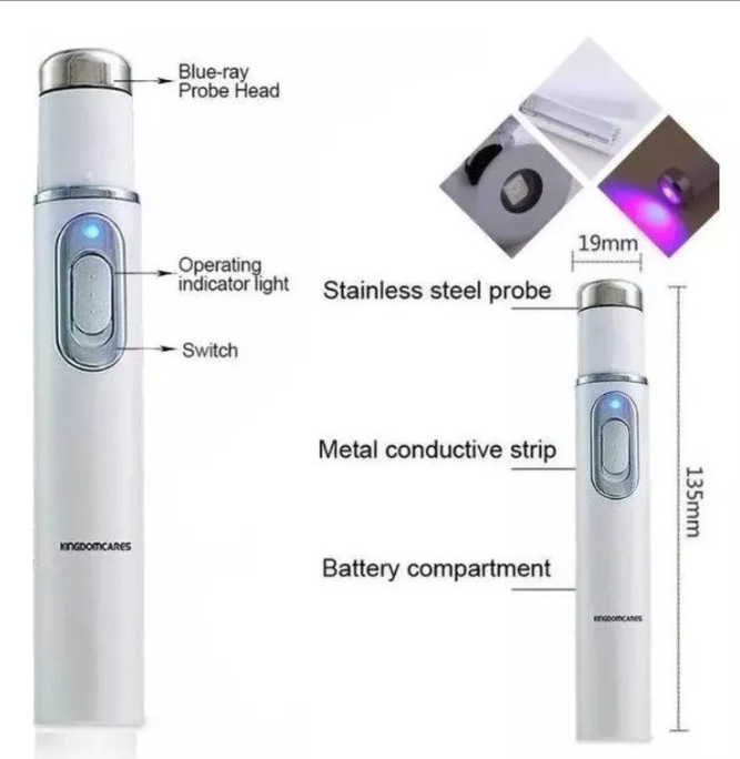 Lápiz Laser Azul para hongos en las uñas
