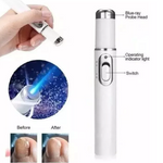 Lápiz Laser Azul para hongos en las uñas