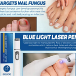 Lápiz Laser Azul para hongos en las uñas