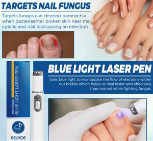 Lápiz Laser Azul para hongos en las uñas