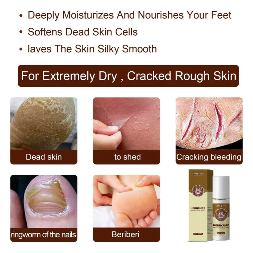 Herb Cure Spray Anti Hongos