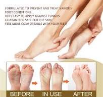 Herb Cure Spray Anti Hongos