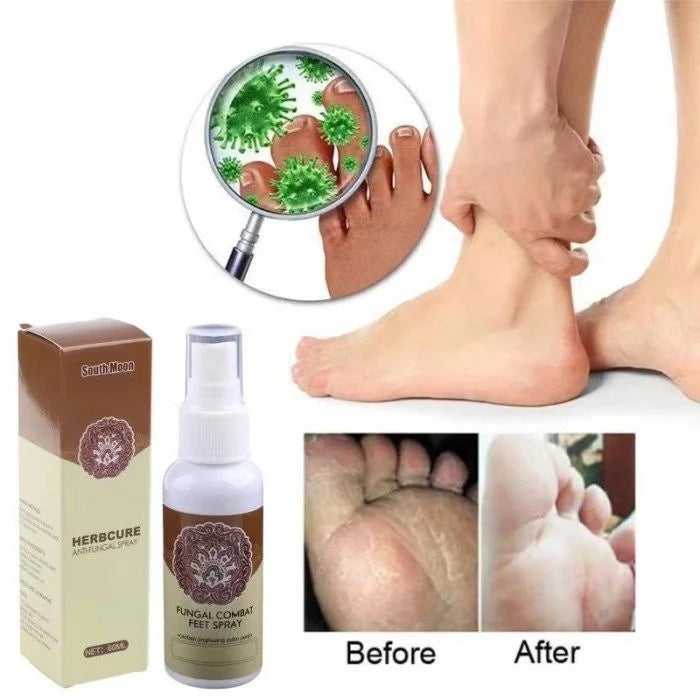 Herb Cure Spray Anti Hongos